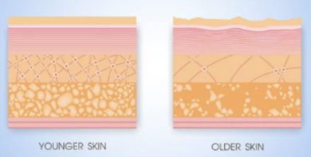 加齢によるお肌のそれぞれの層のダメージ