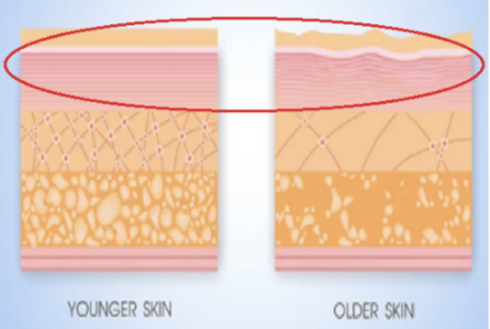 表皮に加齢で起きること