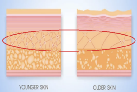 真皮に加齢で起きること