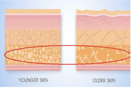 皮下組織に加齢により起こること
